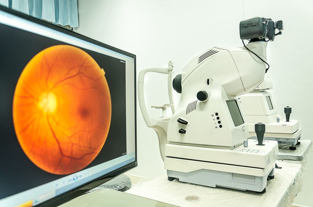 A photograph of the retina and the device used to capture the image